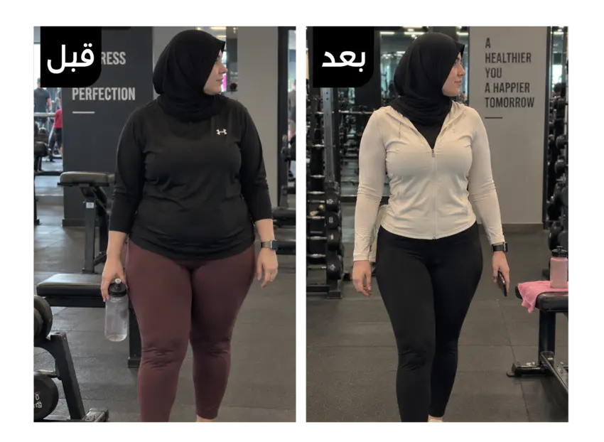 نتيجة قبل وبعد استخدام ترافيس جيل لنسف دهون البطن والأرداف 1